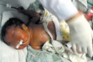 ͼƬ����