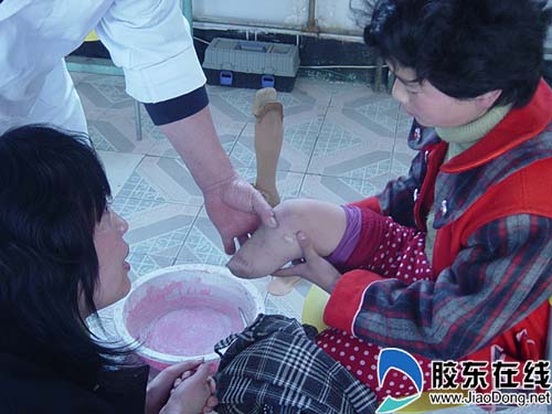11岁残疾<em>女孩</em>圆了<em>假肢</em>心愿