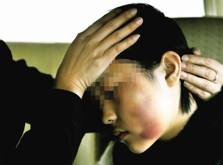 轮番扇<em>耳光打</em>脑袋(图)