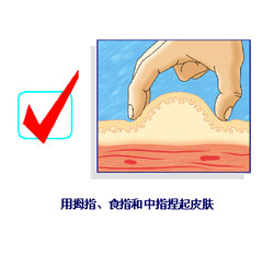 如何正确打胰岛素视频 11844909_413367.jpg