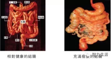 如何拥有健康的肠道 12311317_962916.jpg
