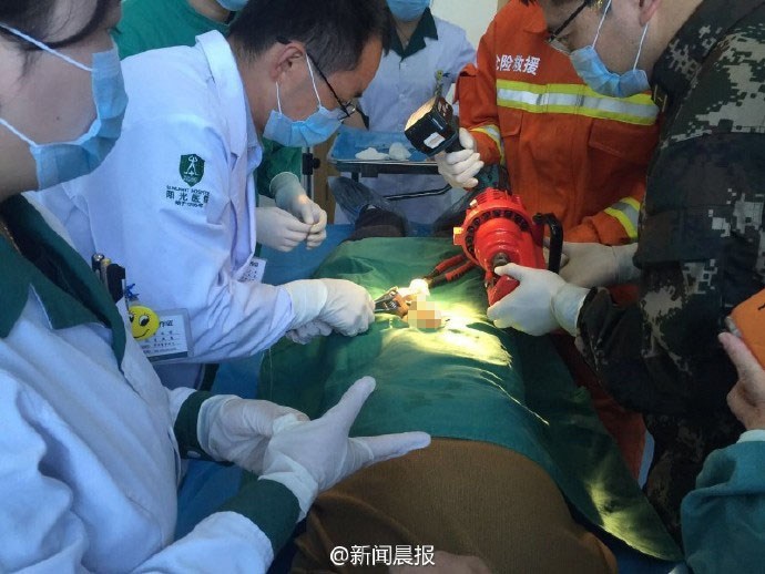 榆林男子生殖器被螺帽套 医生消防帮取下(图)