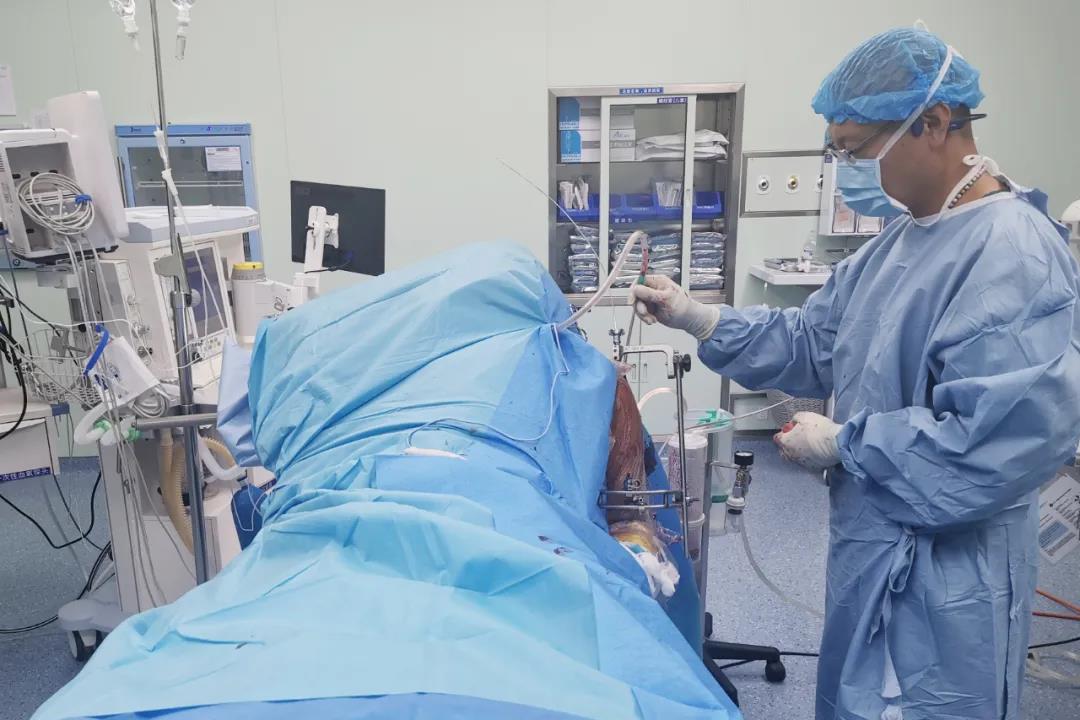 烟台山医院东院创伤二科将医学3d打印技术应用于肱骨近端骨折微创髓内针手术。