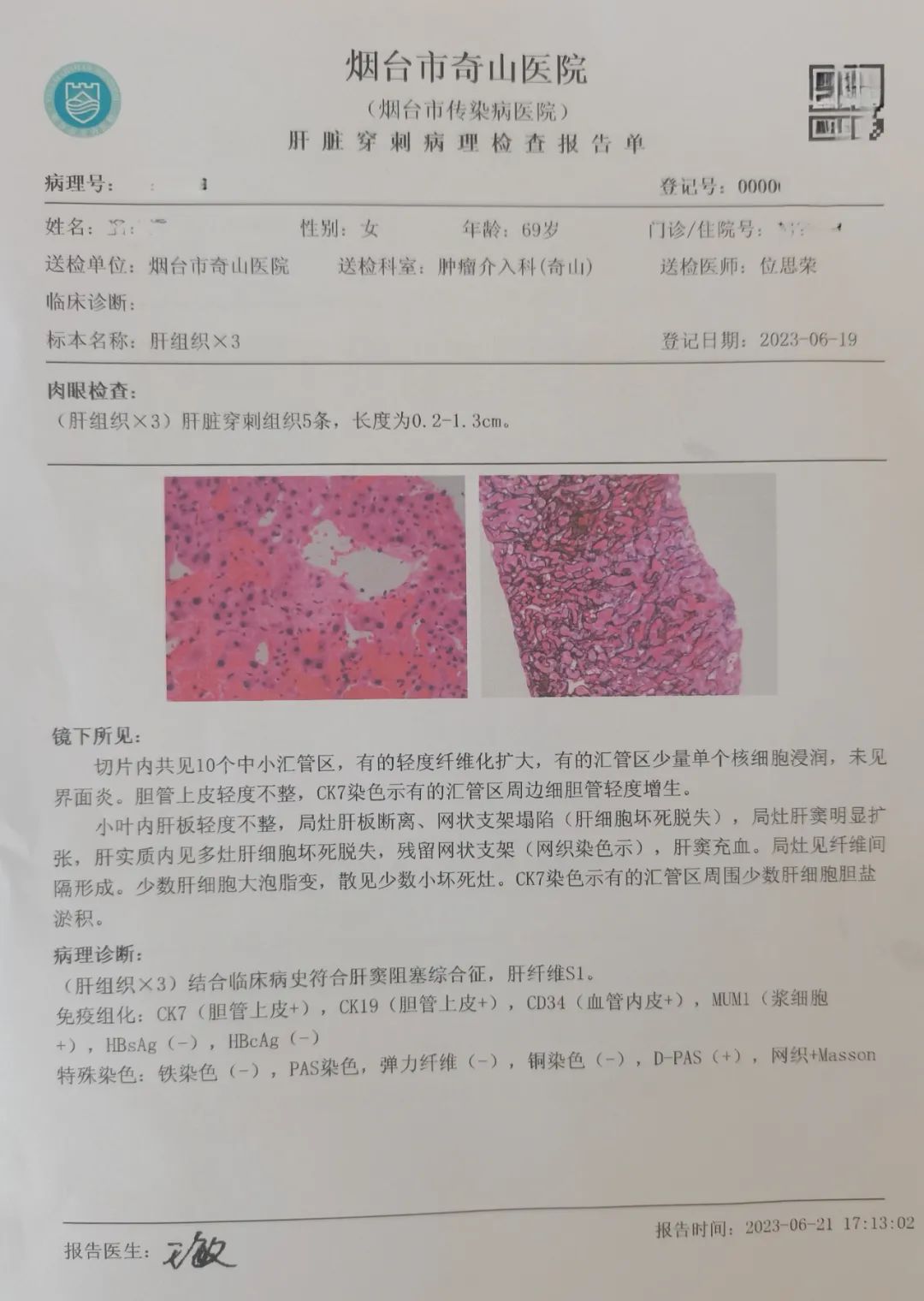 指南推荐｜2022年欧洲肝病学会临床实践指南：血色病