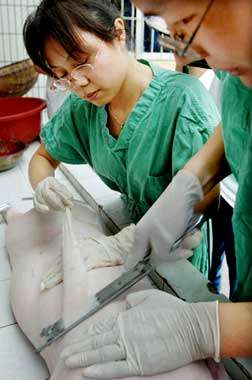 四川女孩全身50%皮肤烧伤 医生取猪皮移植(图)