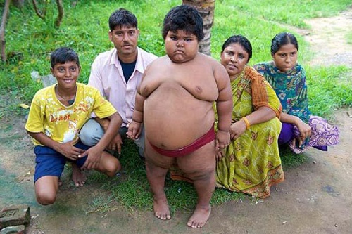 组图印度5岁小胖妞荷尔蒙失衡24小时吃不停