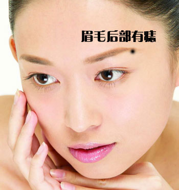 [温馨生活提示]警惕:不要点掉身上的八大吉痣