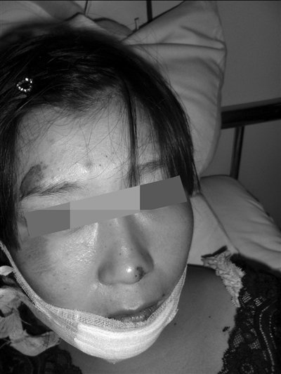 准新娘被遗撒物绊倒投诉无门