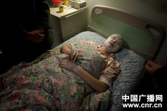 13岁女孩走路鞋子发出噪声遭邻居泼硫酸图