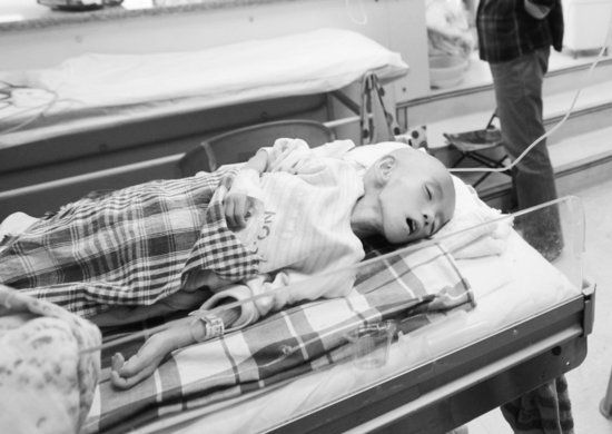 "骷髅娃娃"惠雨鑫严重营养不良 手术后9天离世