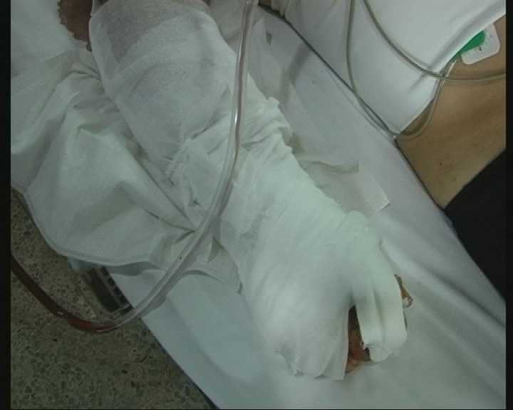 寻目击者男子肋骨被撞断11根肇事车辆逃逸