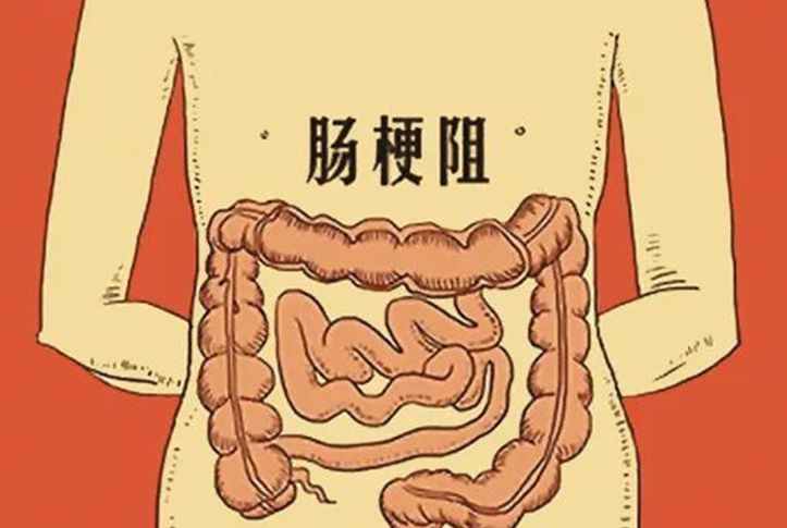 九旬老人肠扭转命悬一线 滨医烟台附院多科室通力协作共渡难关