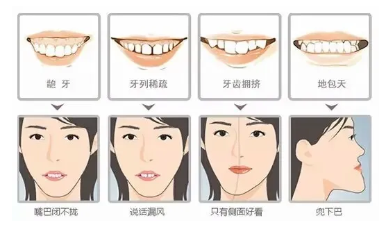 科普|地包天如何治疗好? 科教文体 烟台新闻网 胶东在线 国家批准的重点新闻网站